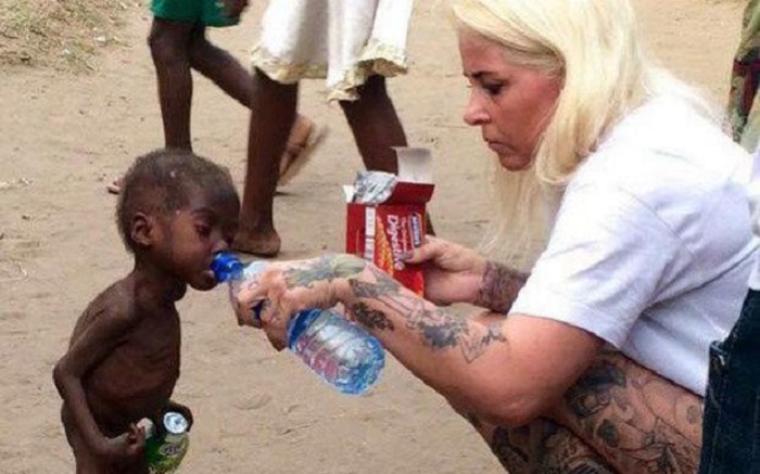 Miracle recovery of emaciated Nigerian `witch child`